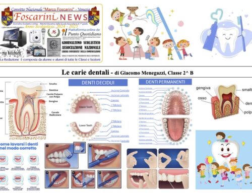 Le carie dentali